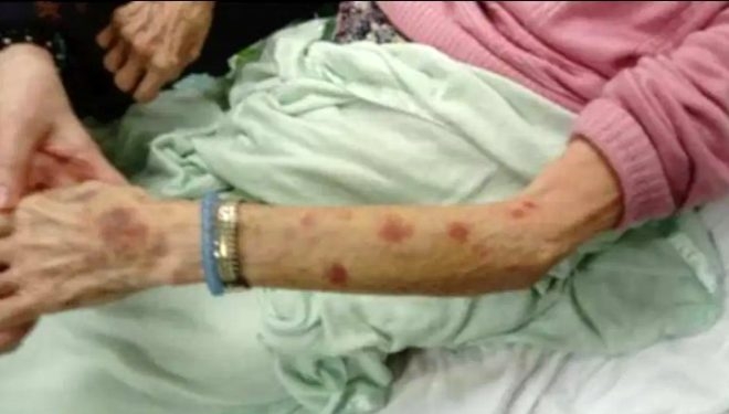 90 yaşındaki kadın, huzurevi çalışanı tarafından tecavüze uğradı 3