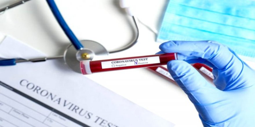 Cistus Creticus bitkisi koronavirüsten koruyor!