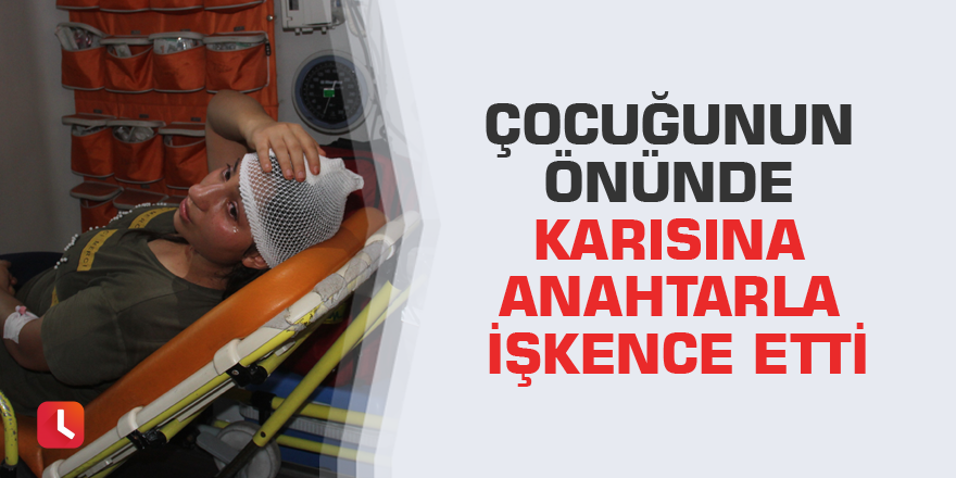 Çocuğunun önünde karısına anahtarla işkence etti