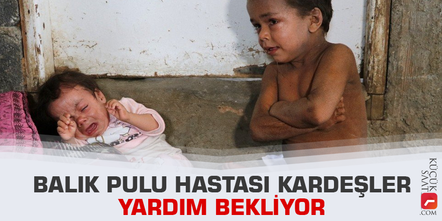 Balık pulu hastası kardeşler yardım bekliyor