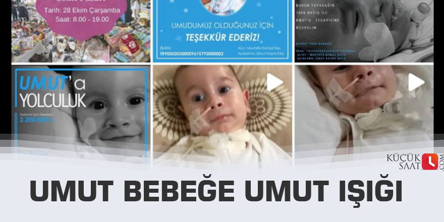 Umut Bebeğe Umut Işığı