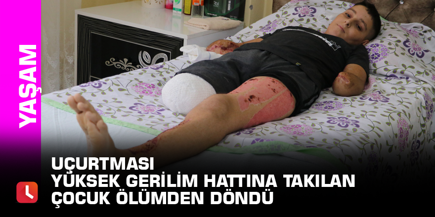 Uçurtması yüksek gerilim hattına takılan çocuk ölümden döndü