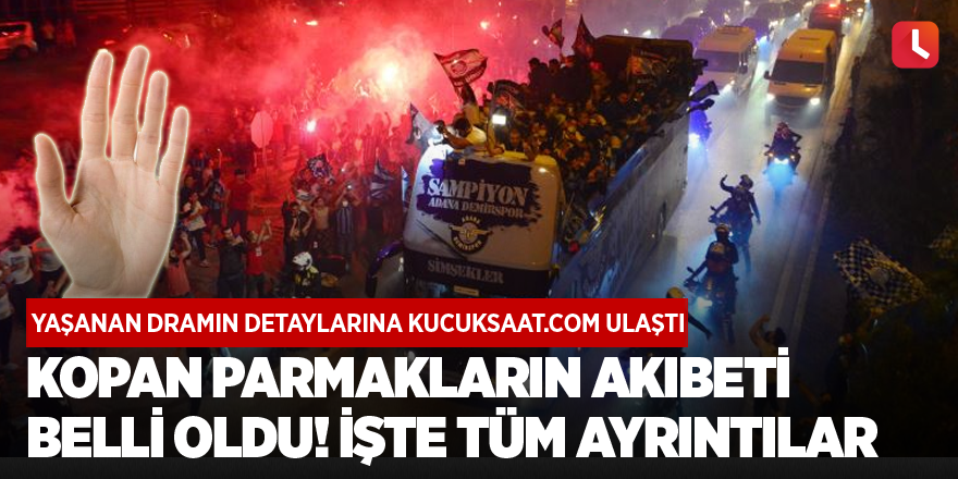 Kopan parmakların akıbeti belli oldu! İşte tüm ayrıntılar