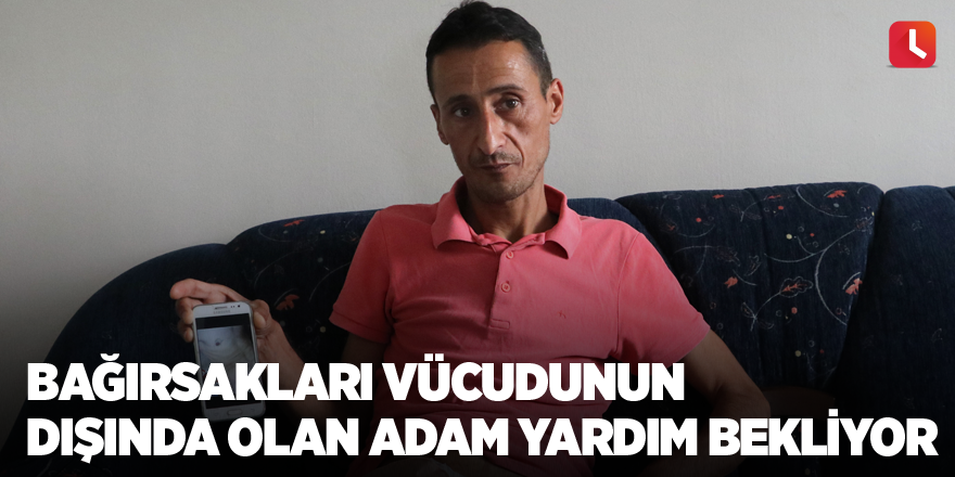 Bağırsakları vücudunun dışında olan adam yardım bekliyor