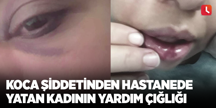 Koca şiddetinden hastanede yatan kadının yardım çığlığı