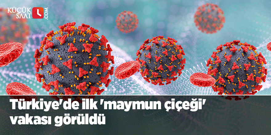 Bakan Koca duyurdu: Türkiye'de ilk 'maymun çiçeği' vakası görüldü