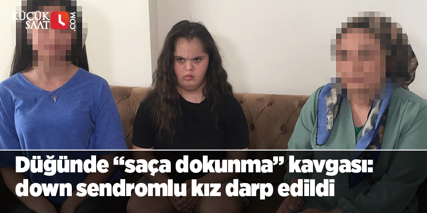 Düğünde down sendromlu kız darp edildi