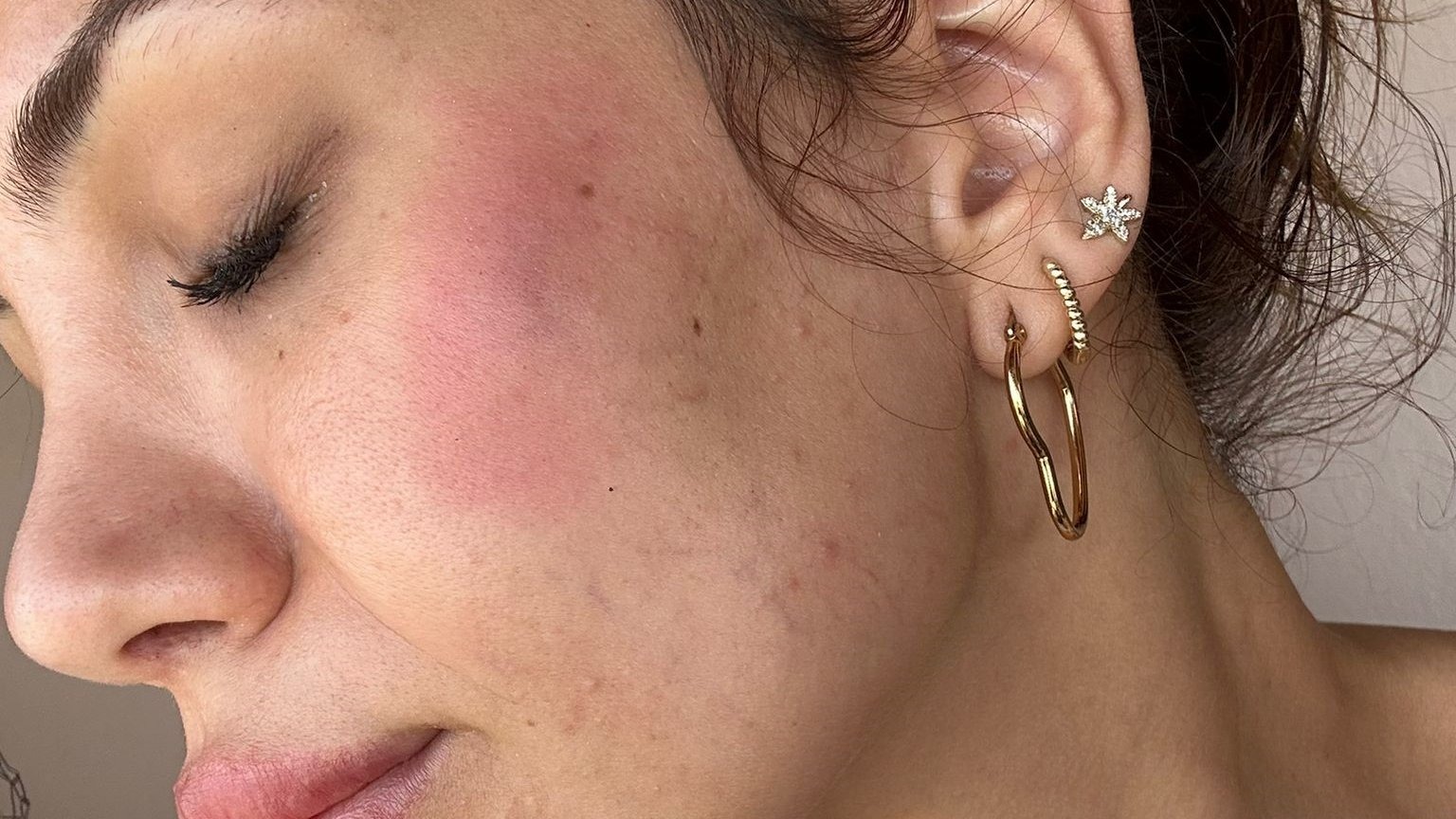 Avukat bunu yaparsa!.. Köpek besleyen komşularını darp etti!