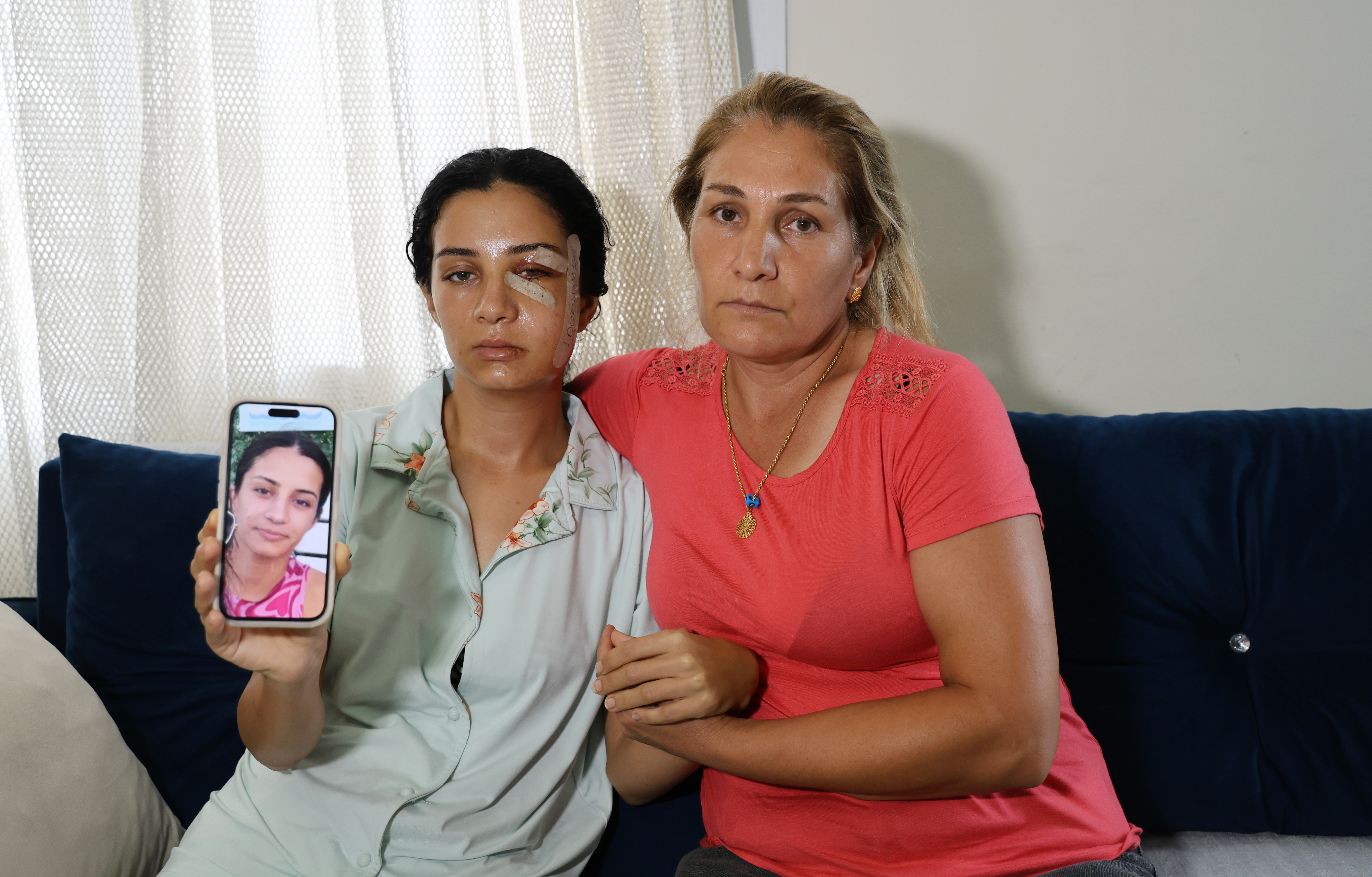 Eski eşinden şiddet gören kadın: "Ben yaşarken kurtulayım, öldükten sonra değil"