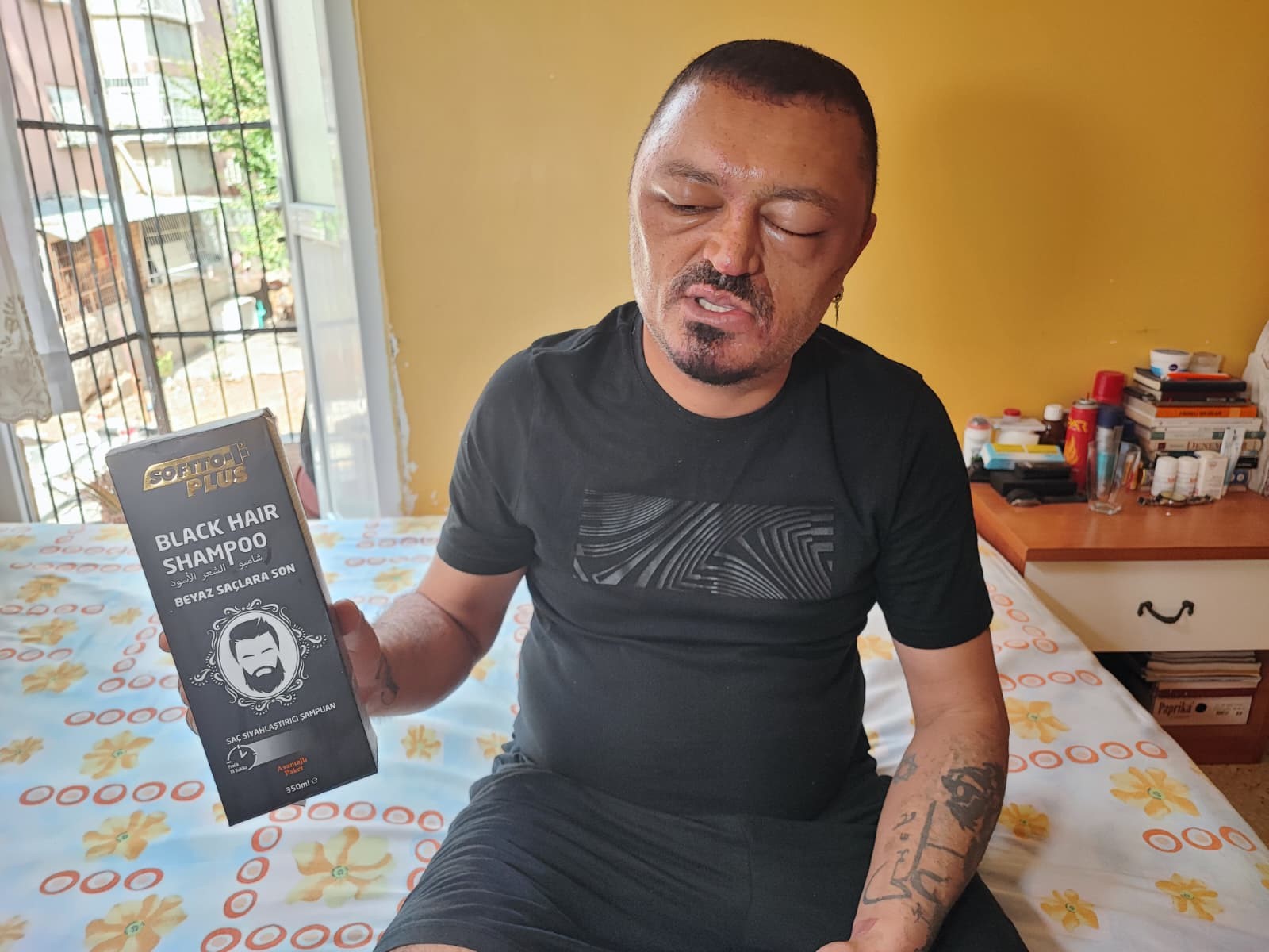 Saçlarını siyahlatmak için aldığı şampuan arı sokmasından beter hale getirdi