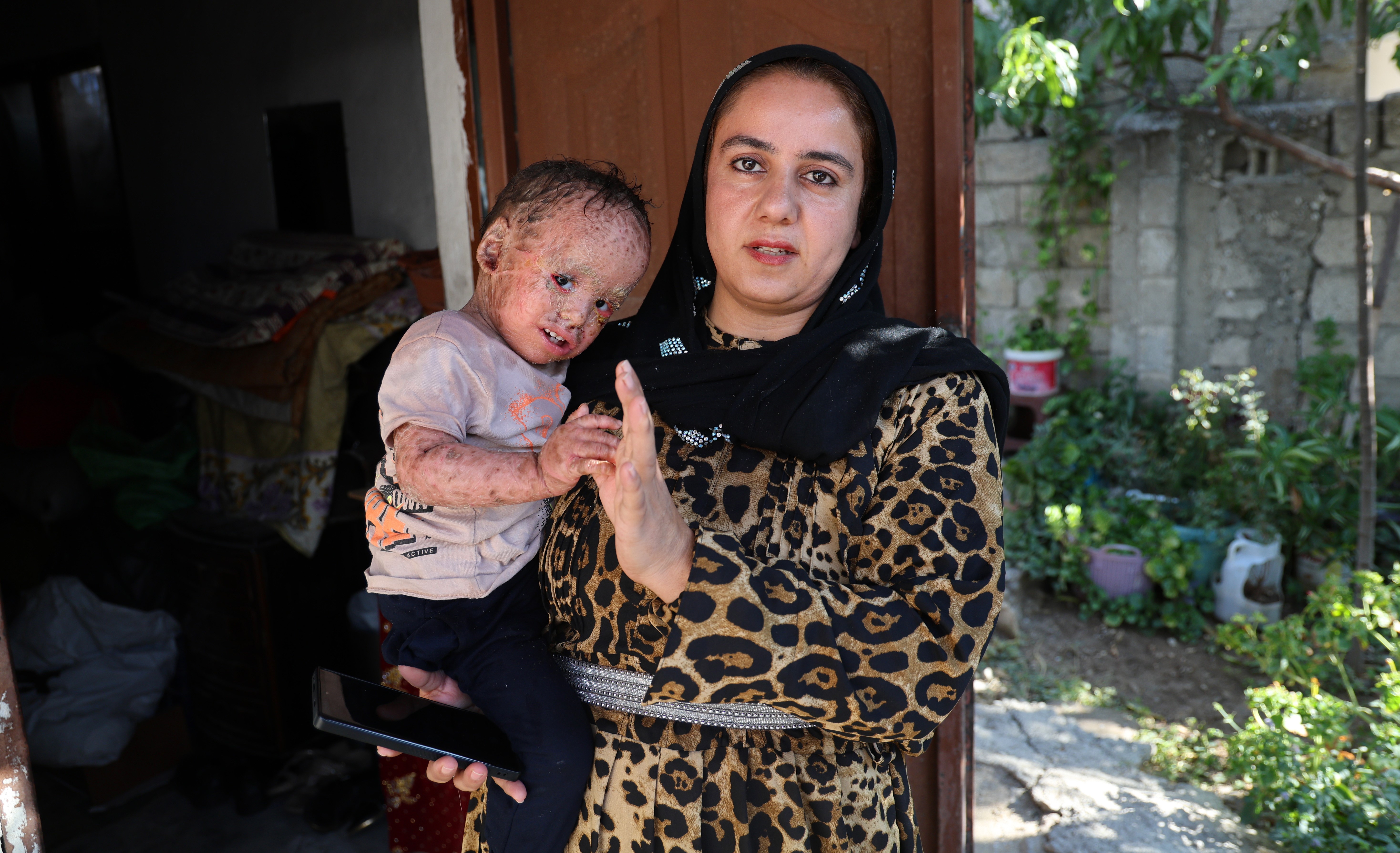 Balık pulu ve kelebek hastası Yusuf'un yardım paralarını dolandırıcılar topladı