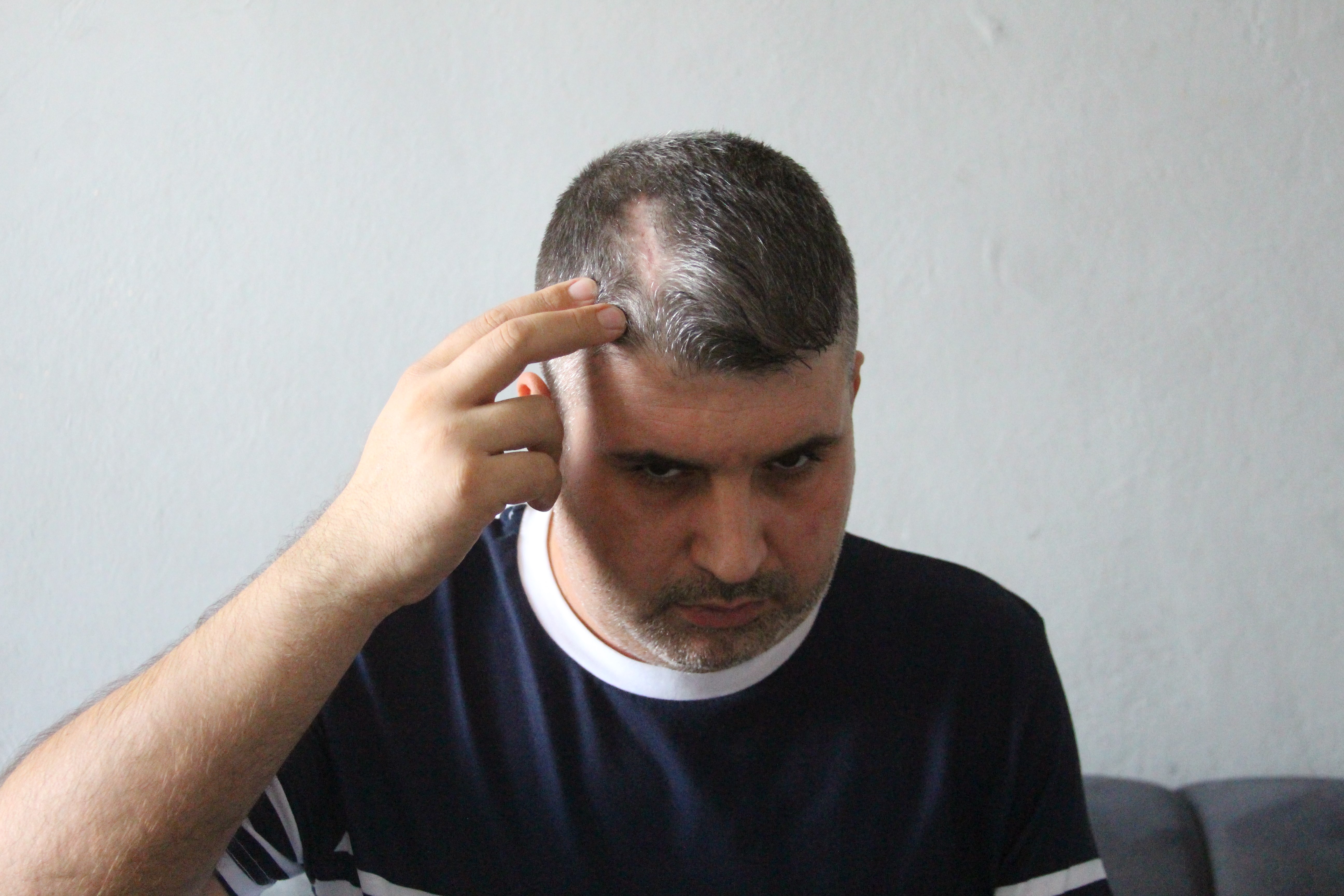 Dayısının saldırısına uğrayan Alpaltun, "Can güvenliğim yok"   