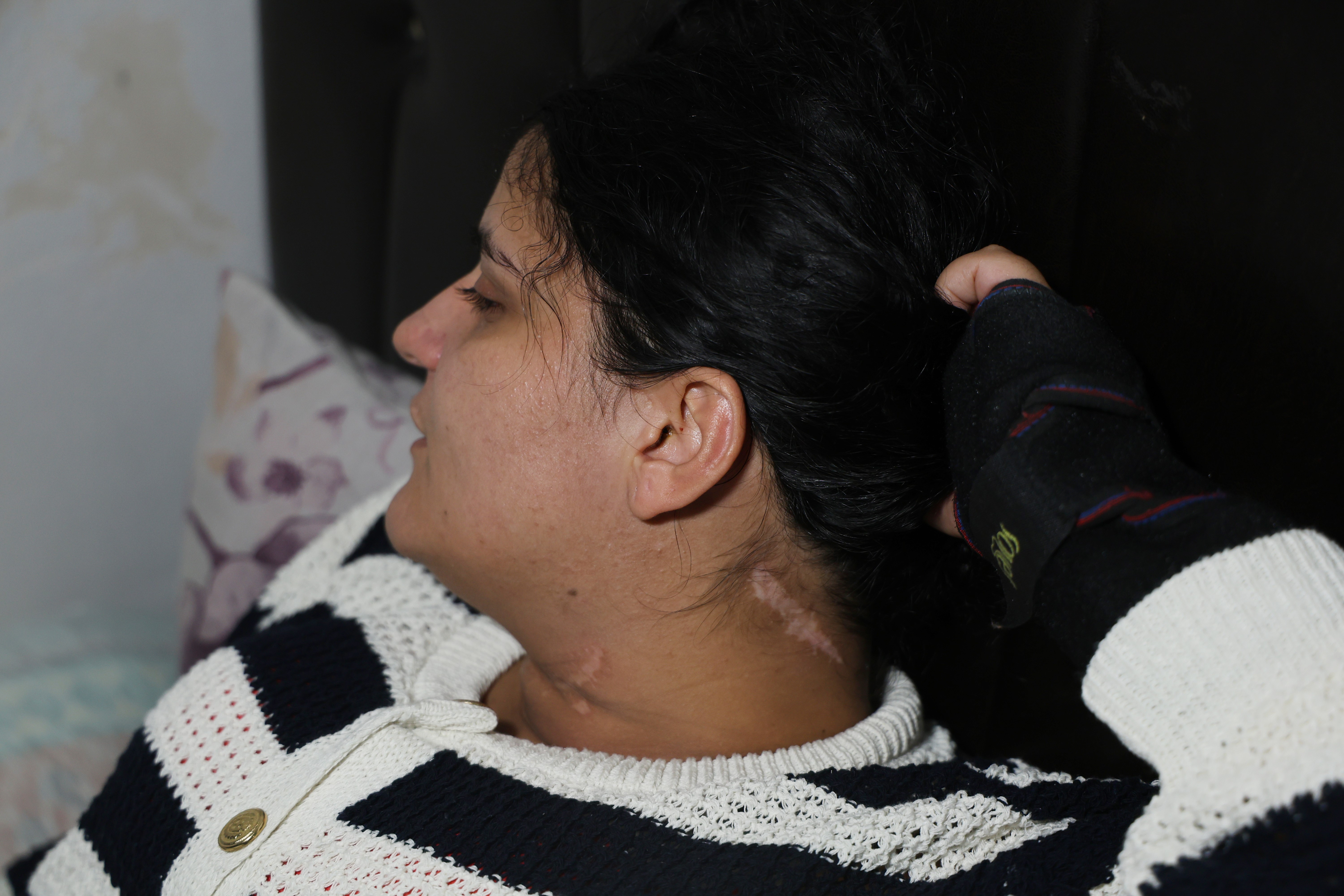 Eşi boğazını kesti engelli kaldı: 2 çocuk annesi dehşet anlarını ilk kez anlattı