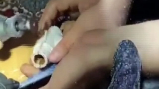 Parmağını kombi borusuna sıkıştırdı