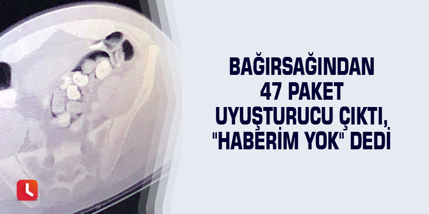 Bağırsağından 47 paket uyuşturucu çıktı, "haberim yok" dedi