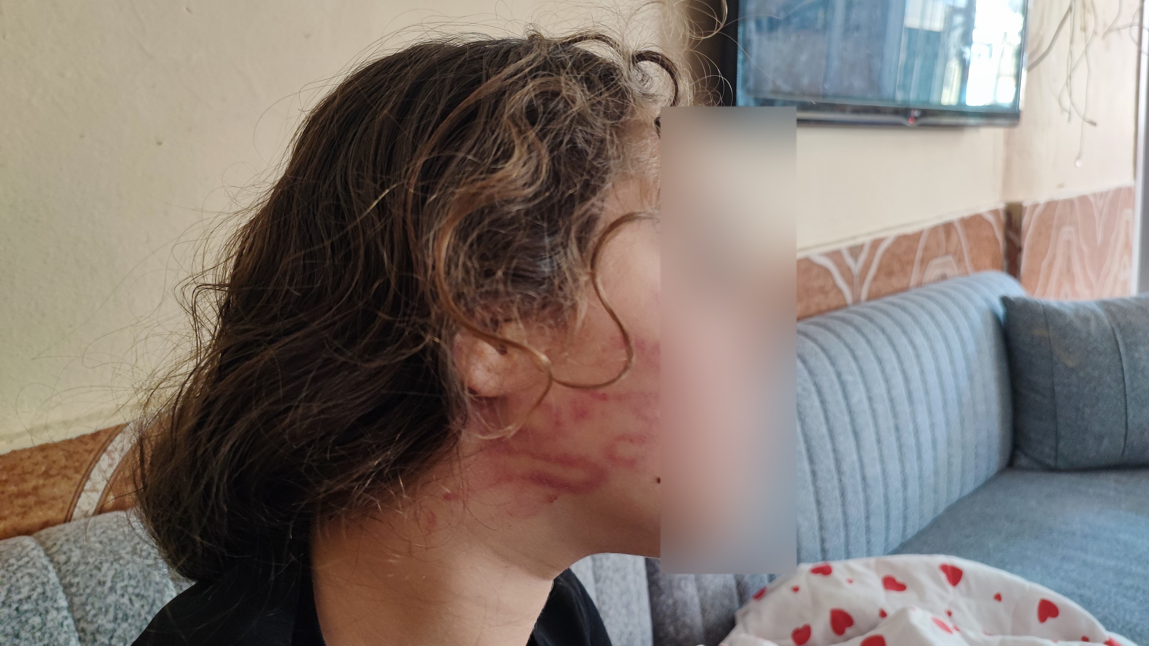 8 yaşındaki kızını darp eden çocuğun epilepsi hastası ablasını darp ettiler