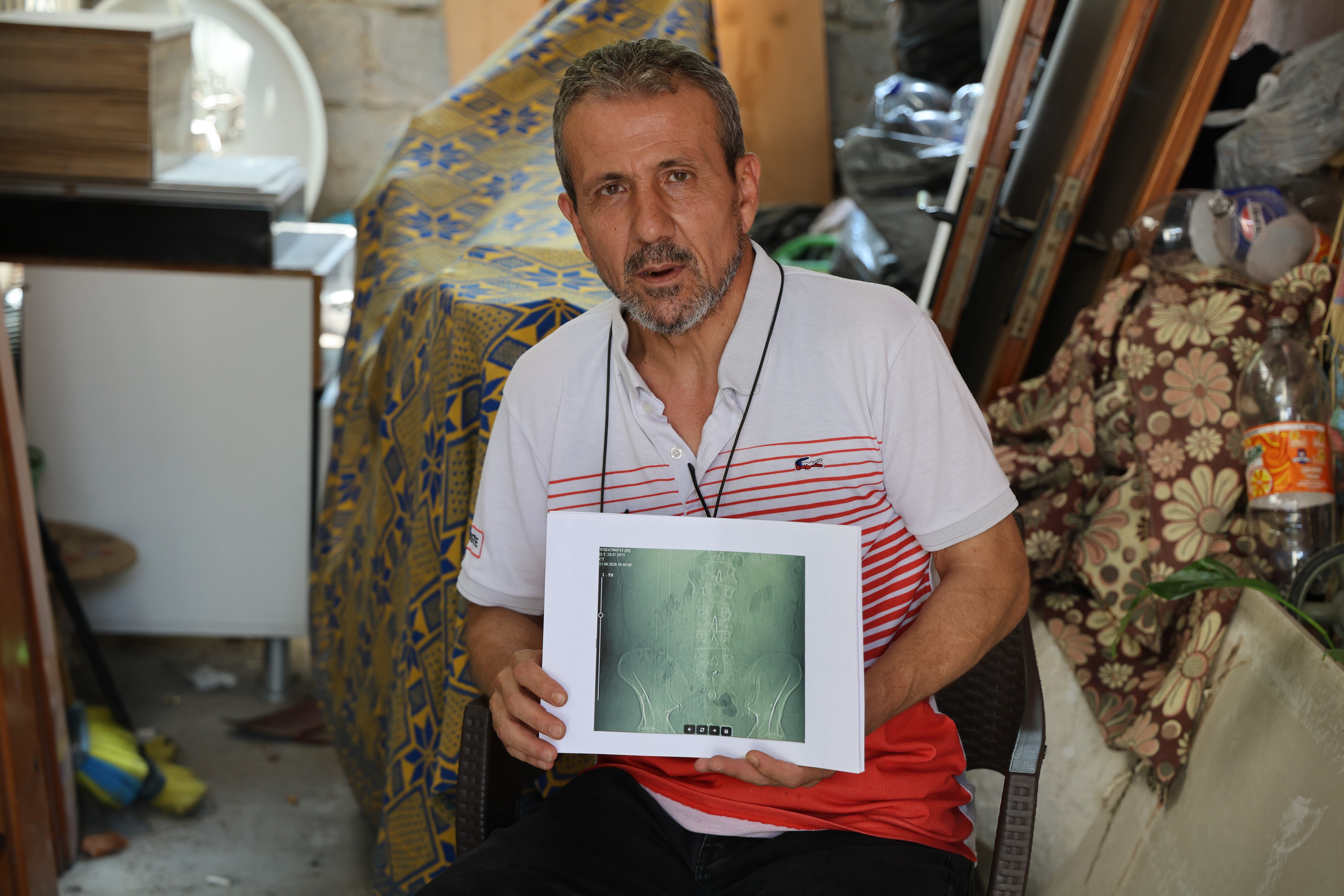 İş kazası sonrası ameliyat oldu, hayatı kabusa döndü