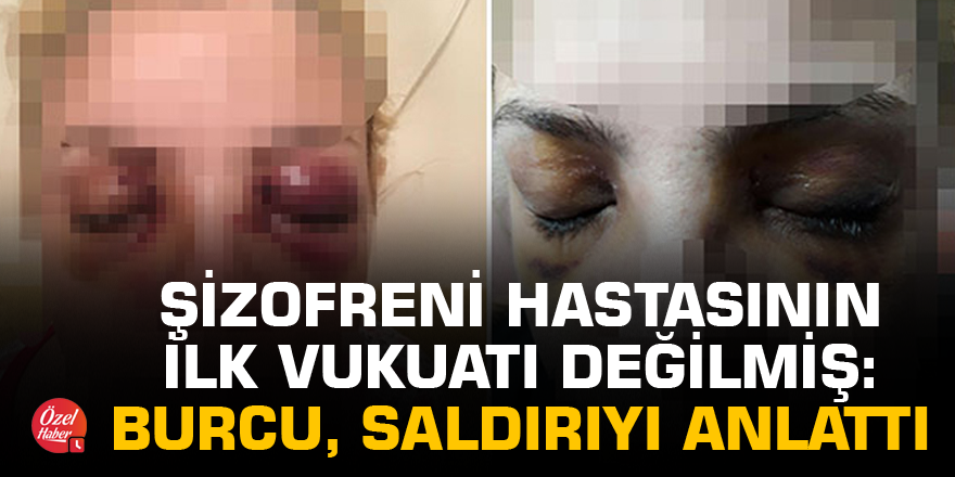 Şizofreni hastasının ilk vukuatı değilmiş: Burcu, saldırıyı anlattı