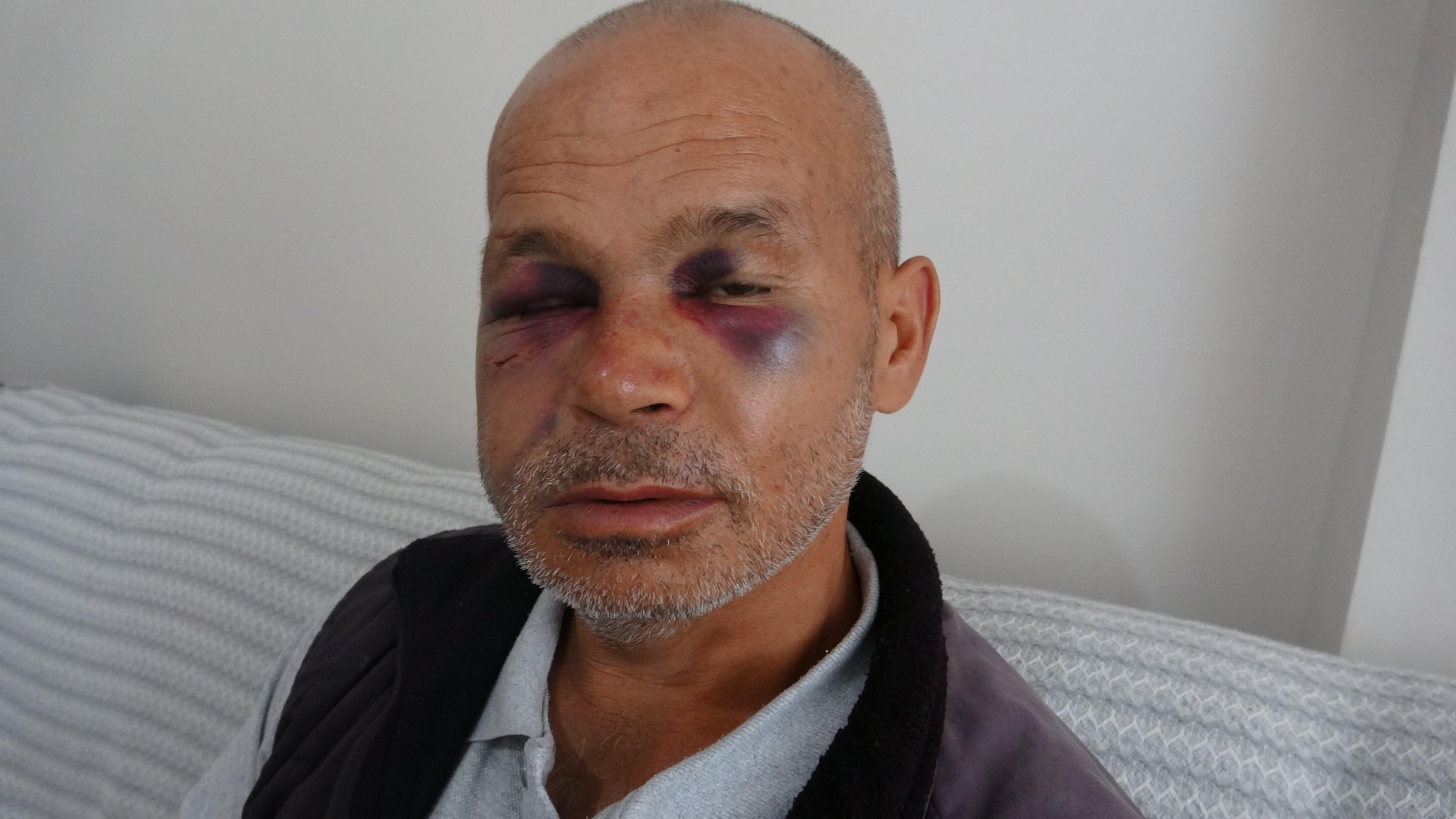 Kozan’da engelli adamı darbeden şüpheli serbest bırakıldı