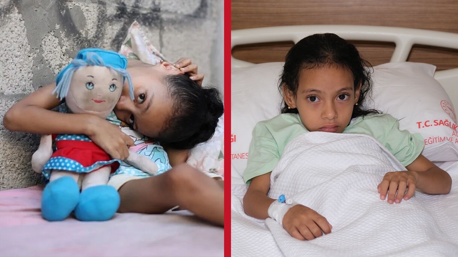 İsrail saldırılarında yaralanan Filistinli Sıla, Adana’da tedavi altına alındı