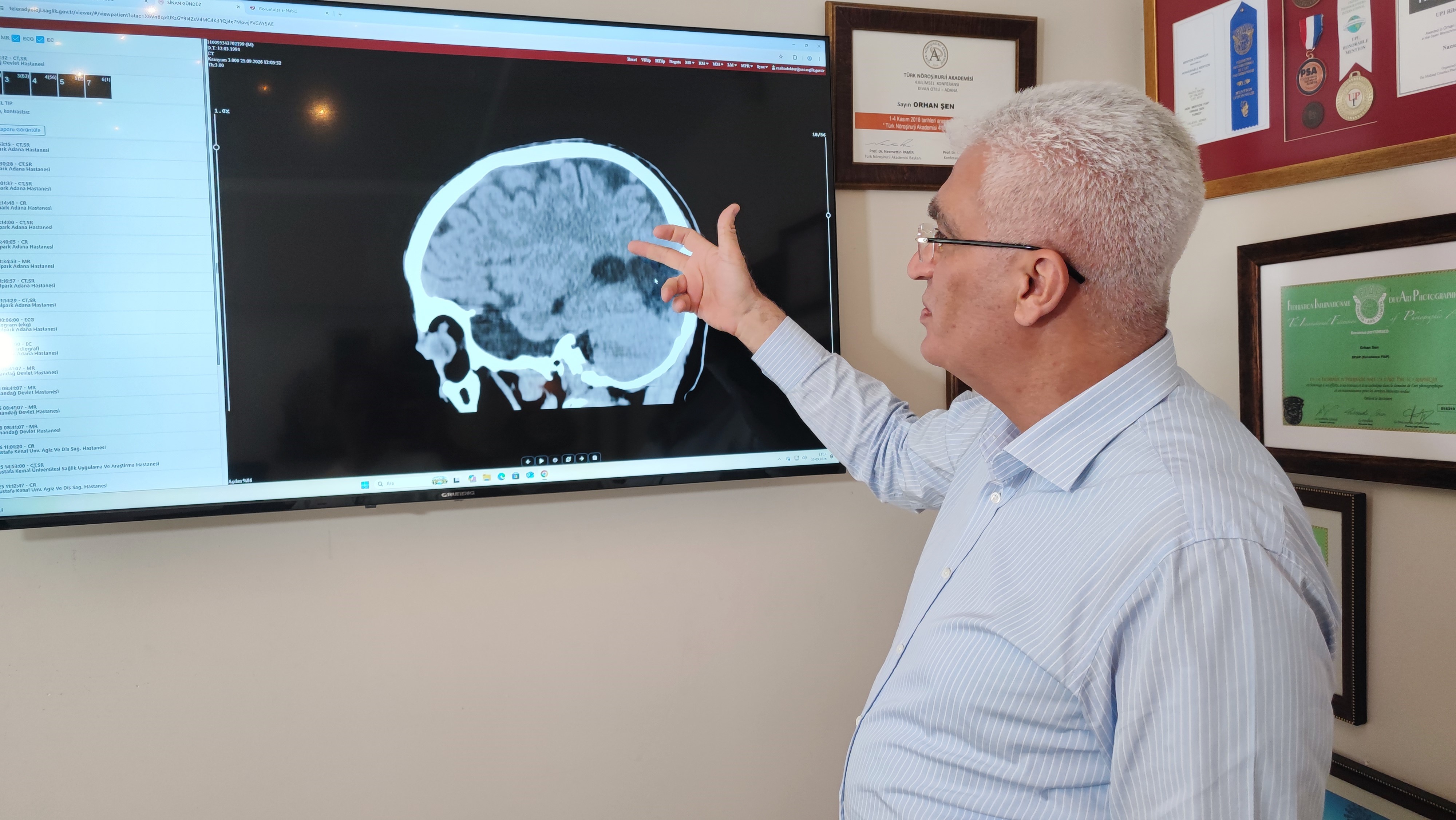 Prof. Dr. Orhan Şen’den inme uyarısı: Hareketsizlik, stres ve uyku düzensizliğine dikkat