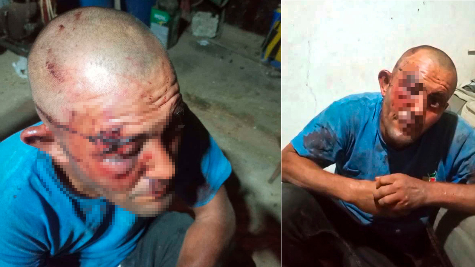 Ceyhan’da sosyal medyada tanınan zihinsel engelli genç darbedildi