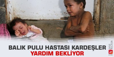 Balık pulu hastası kardeşler yardım bekliyor