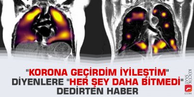 "Korona geçirdim iyileştim" diyenlere "her şey daha bitmedi" dedirten haber