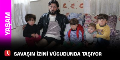 Savaşın izini vücudunda taşıyor