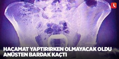 Hacamat yaptırırken olmayacak oldu Anüsten bardak kaçtı