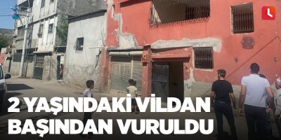 2 yaşındaki Vildan başından vuruldu