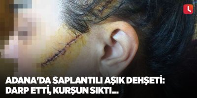 Adana'da saplantılı aşık dehşeti: Darp etti, kurşun sıktı...