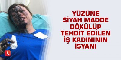 Yüzüne siyah madde dökülüp tehdit edilen iş kadınının isyanı