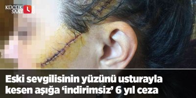 Eski sevgilisinin yüzünü usturayla kesen aşığa ‘indirimsiz’ 6 yıl ceza