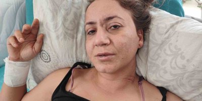 Emlakçı kadını vurdular, silah tutukluk yapınca hayatta kaldı