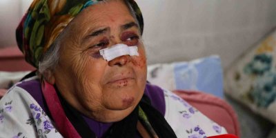Otomobilin çarptığı yaşlı kadın: "Gözümün içine bakıp kaçtı"