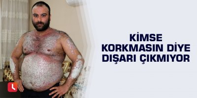 Kimse korkmasın diye dışarı çıkmıyor