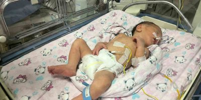 Annesi kazada ölüp sezaryenle dünyaya gelen bebek hayata tutundu