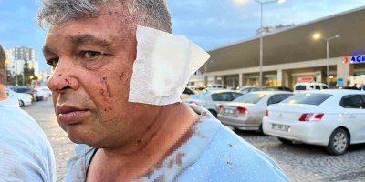 Dolmuş sürücüsüyle yol verme yüzünden tartışan abi ve kardeş darp edildi