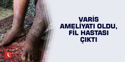 Varis ameliyatı oldu, fil hastası çıktı