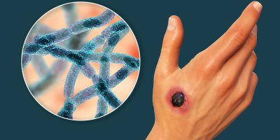 Feke’de şarbon hastalığı görüldü; aşılama çalışması başladı