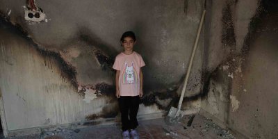 Lösemi hastası Almina’nın evi yandı