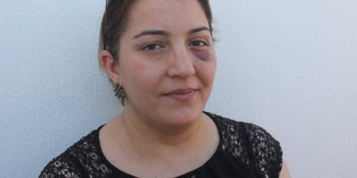 Çarptığı çocuğa müdahale etmek isteyen hemşire darp edildi