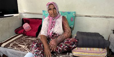 Kolu şişti, vücuduna kadar yara oldu: 4 çocuk annesinin zorlu yaşamı