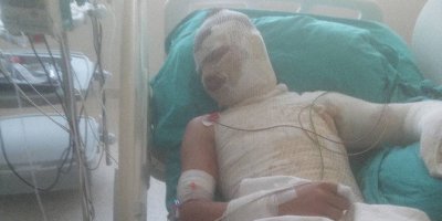 Yeğenini yakan amca, suçu ağabeyine attı