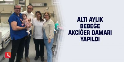 Altı aylık bebeğe akciğer damarı yapıldı