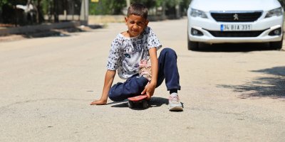 Kaza sonrası ayağı yanlış kaynadı, hayatı kaykay üzerinde geçiyor