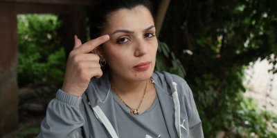 Cezaevinden firar etti, yüzünü bıçakladığı kadına 'Affına sığınıyorum' mesajı attı