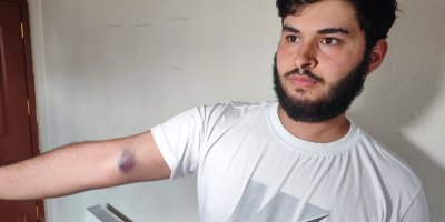 Conolar hem topu vermedi hem de aileye sopalı silahlı saldırıda bulundu