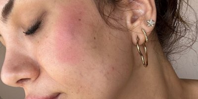 Avukat bunu yaparsa!.. Köpek besleyen komşularını darp etti!